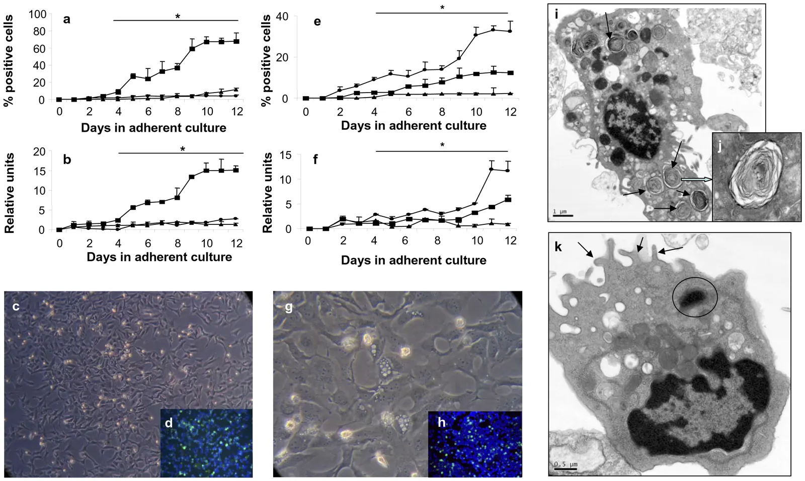 Foto de arquivo: Figure 3. Phenotypic analysis and ultrastructure of hES cells differentiated to lung epithelial cell-specific lineages. EBs derived from H7 